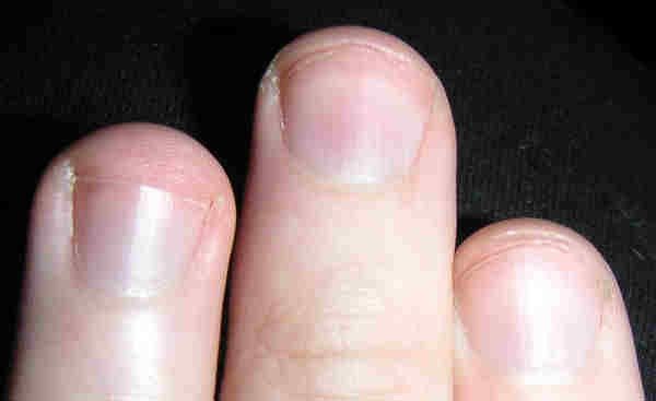 A 2010 study found fingernails grew about 3.47 millimeters a month on average, more than twice as fast as toenails, which grew 1.62 millimeters.