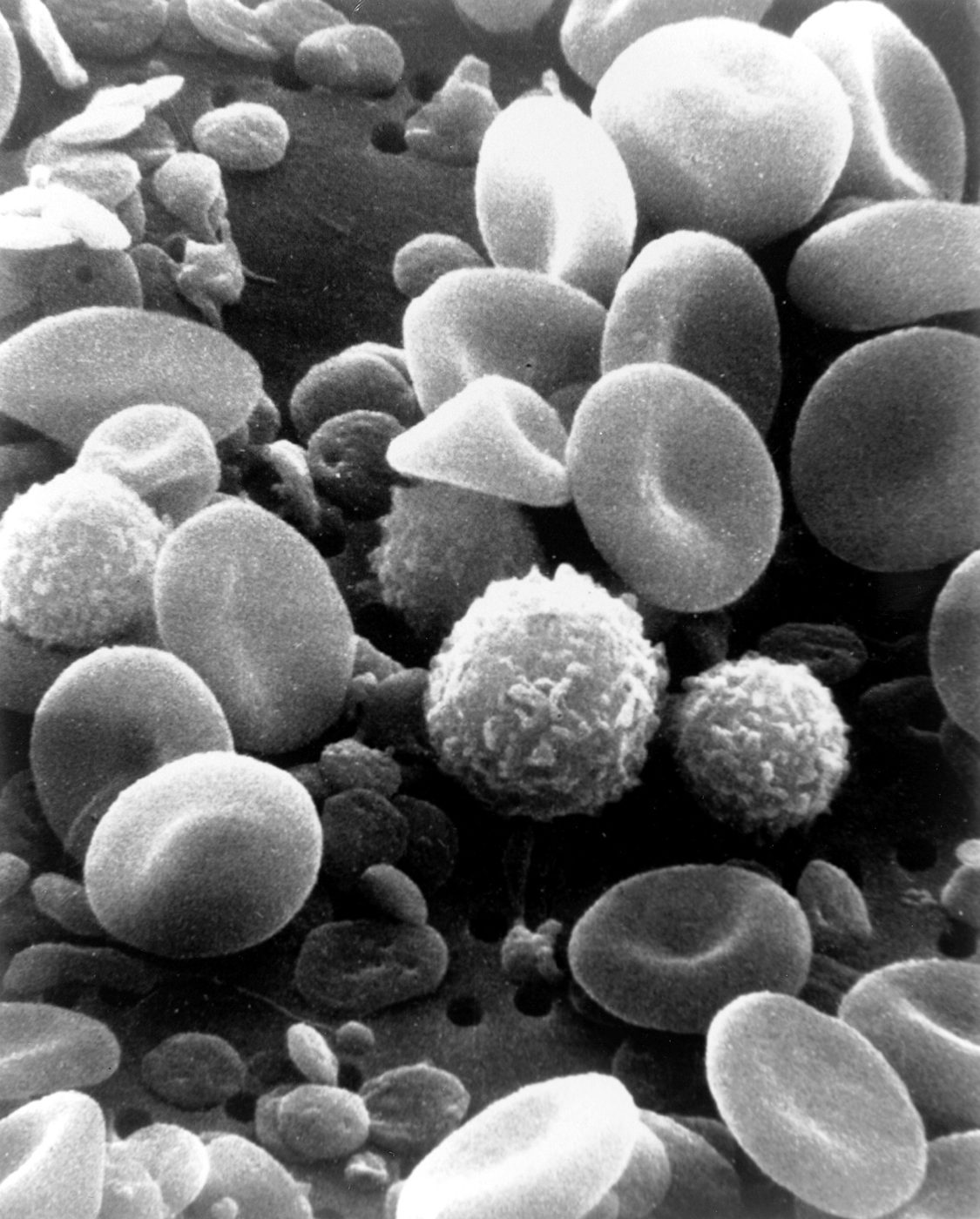 In a healthy person, a red blood cell usually survives for about 120 days, a 2023 review notes. Mature human red blood cells also have no nucleus.