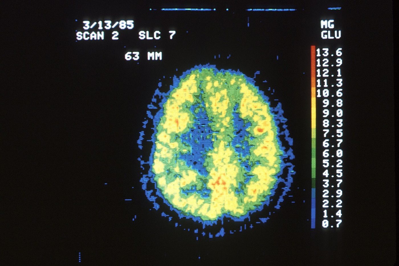 In the average adult at rest, the brain is only about 2% of body weight, yet it uses about 20% of the oxygen and calories the body consumes.