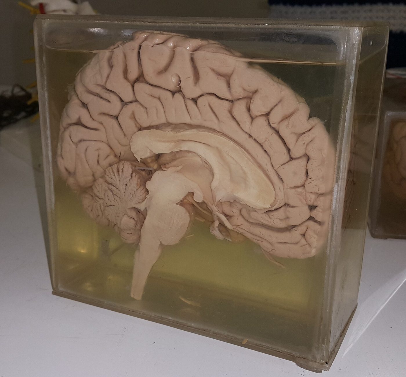 The human brain is often said to hold 100 billion neurons. When researchers counted in 2009, adult male brains averaged about 86 billion.