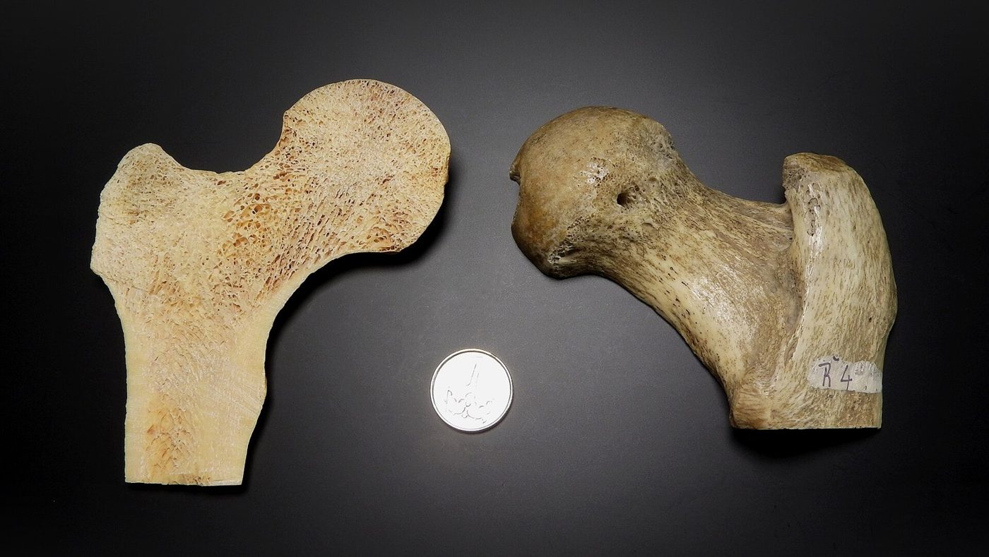 Your skeleton is not as permanent as it looks. Bone is constantly broken down and rebuilt, and most of the adult skeleton is replaced about every 10 years.